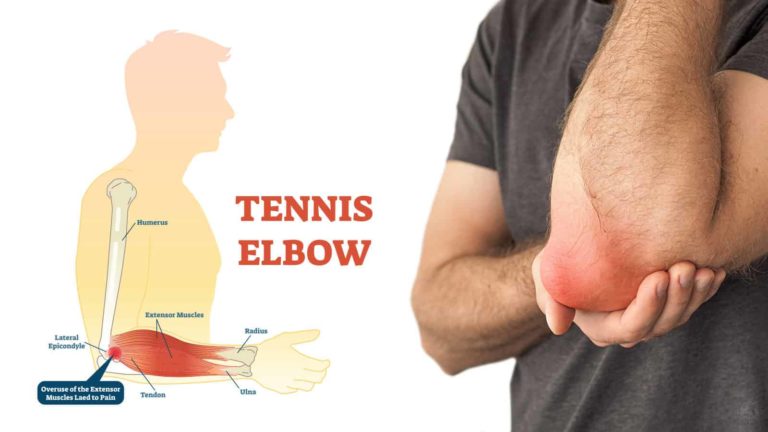 Tennis Elbow Symptoms Treatment And Prevention Tips Tristate Arthritis Rheumatology