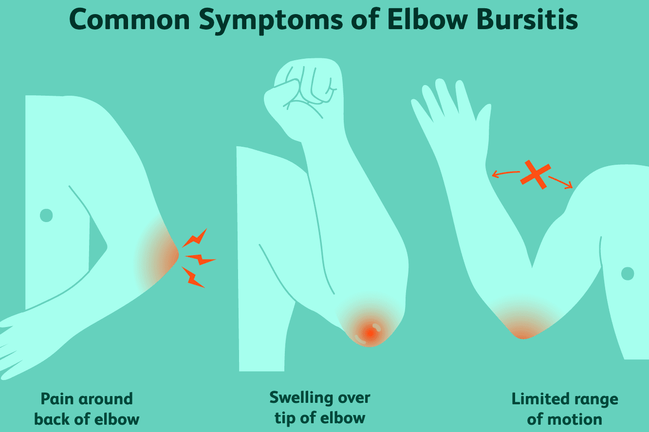 Think You Have Golfer’s Elbow? Here are the Symptoms and What You Can ...